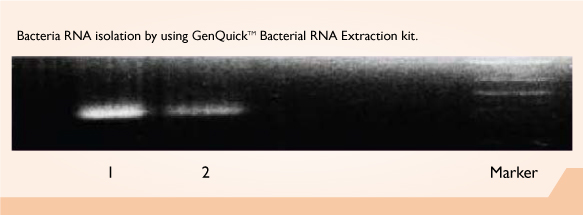 GenQuikTM Bacterial RNA Kit
