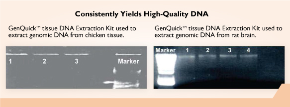 GenQuikTM Tissue DNA Kit